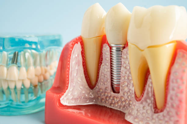 Reliable Millville, DE Dental Services Solutions