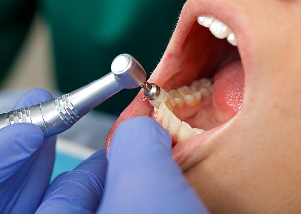 Best Tooth Extraction  in Millville, DE